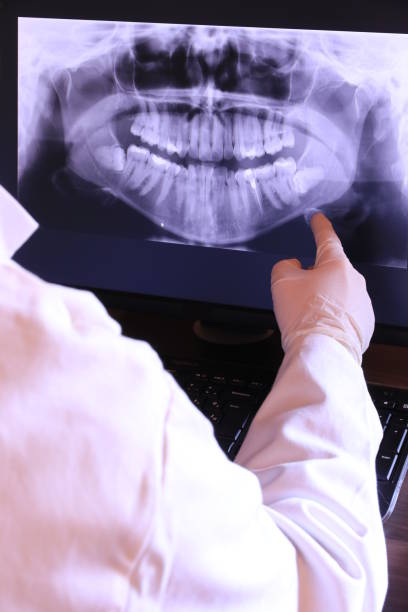 Best Emergency Wisdom Tooth Extraction in Bixby, OK