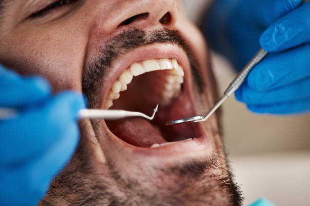 Best Emergency Root Canal Therapy in Bixby, OK